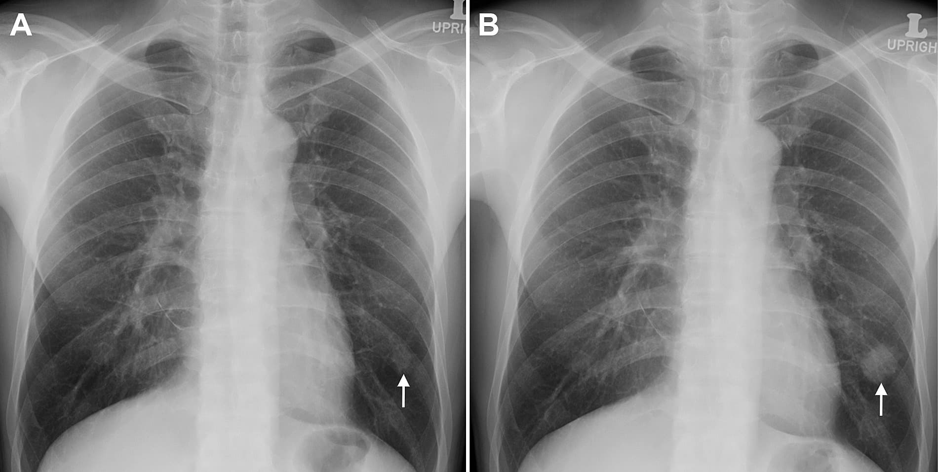 An image of the Chest Cancer Detection web-app project.